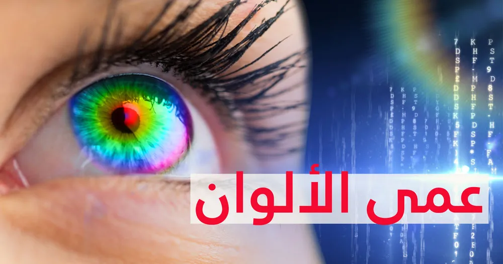 عمى الألوان
